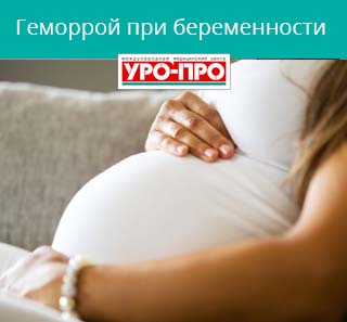 Геморрой у беременных: причины, симптомы, лечение | Клиника «Наедине»