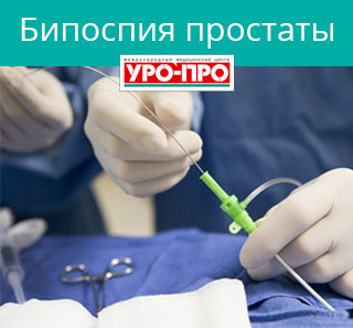 Cделать биопсию простаты в Ростове-на-Дону