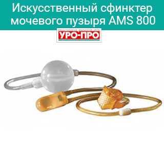 Искусственный сфинктер мочевого пузыря AMS 800